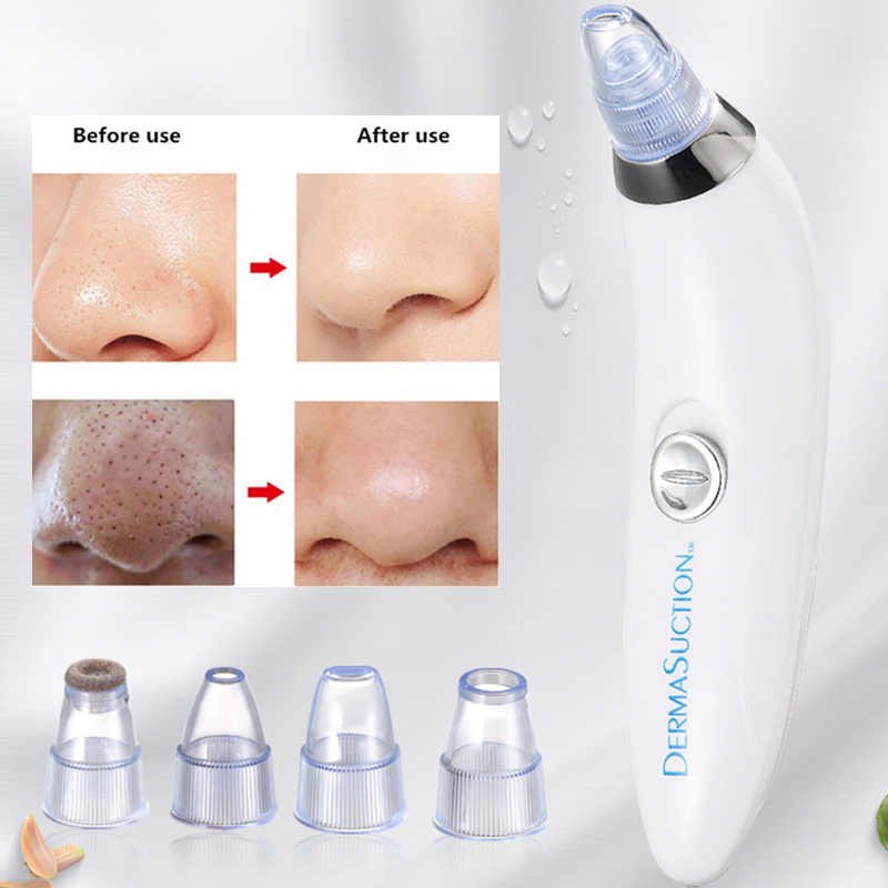 PRODESIRE™ DERMA SUCTION MACHINE (CELL OPERATED)