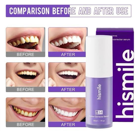 HISMILE V34 TEETH WHITENING SERUM – PURPLE COLOUR CORRECTOR FOR YELLOW TONES